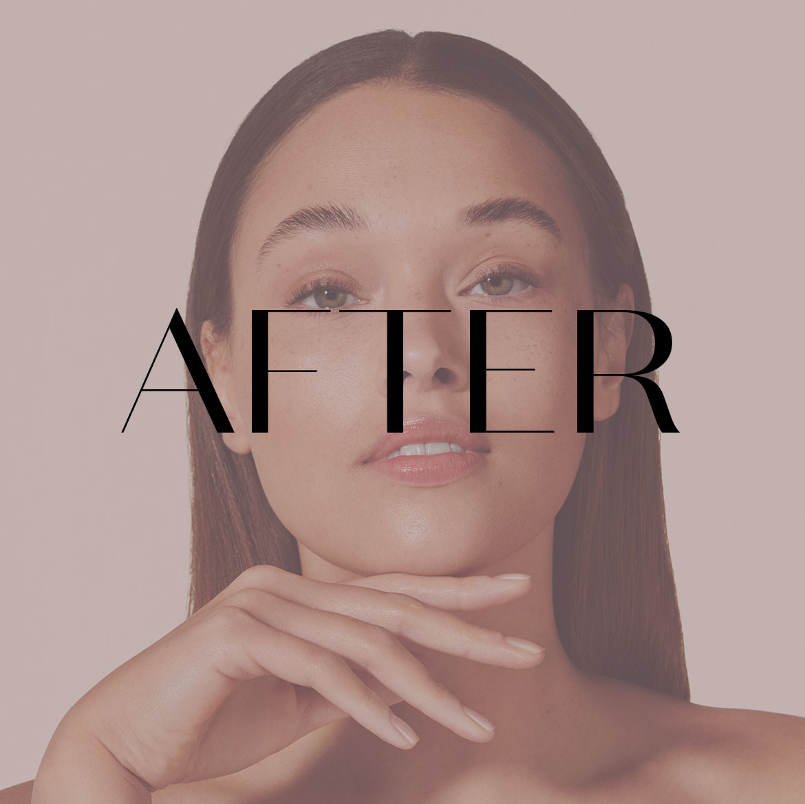 Before &amp; After Example: After