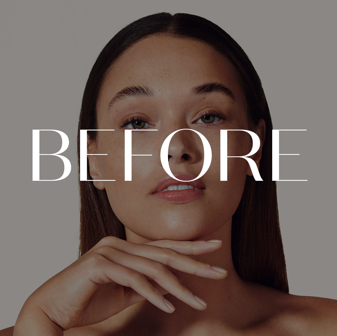 Before &amp; After Example: Before