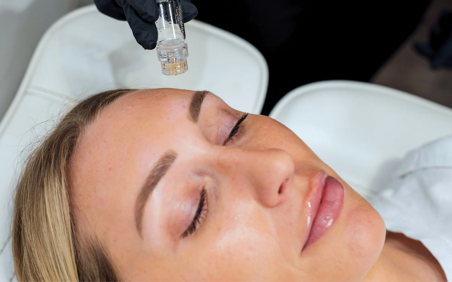 AquaGold Facial at Renew Beauty Med Spa in Dallas and Frisco