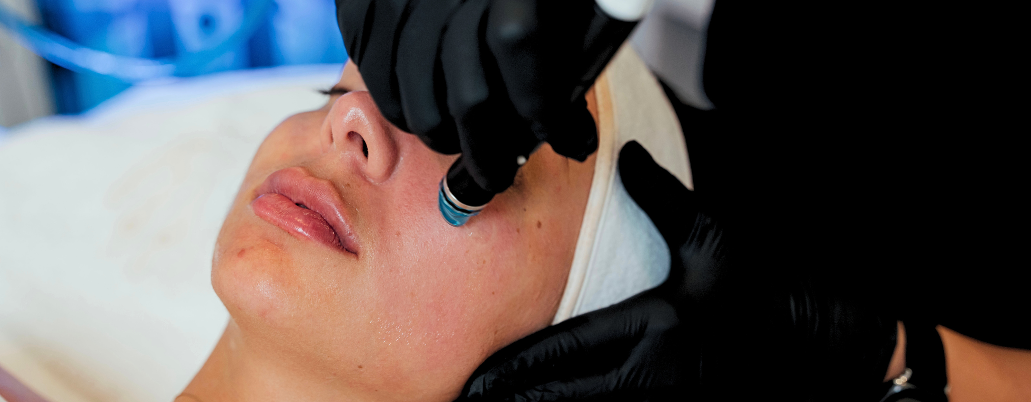 Award-Winning Glow: Renew Beauty Med Spa Named “Best HydraFacial” by Modern Luxury Dallas