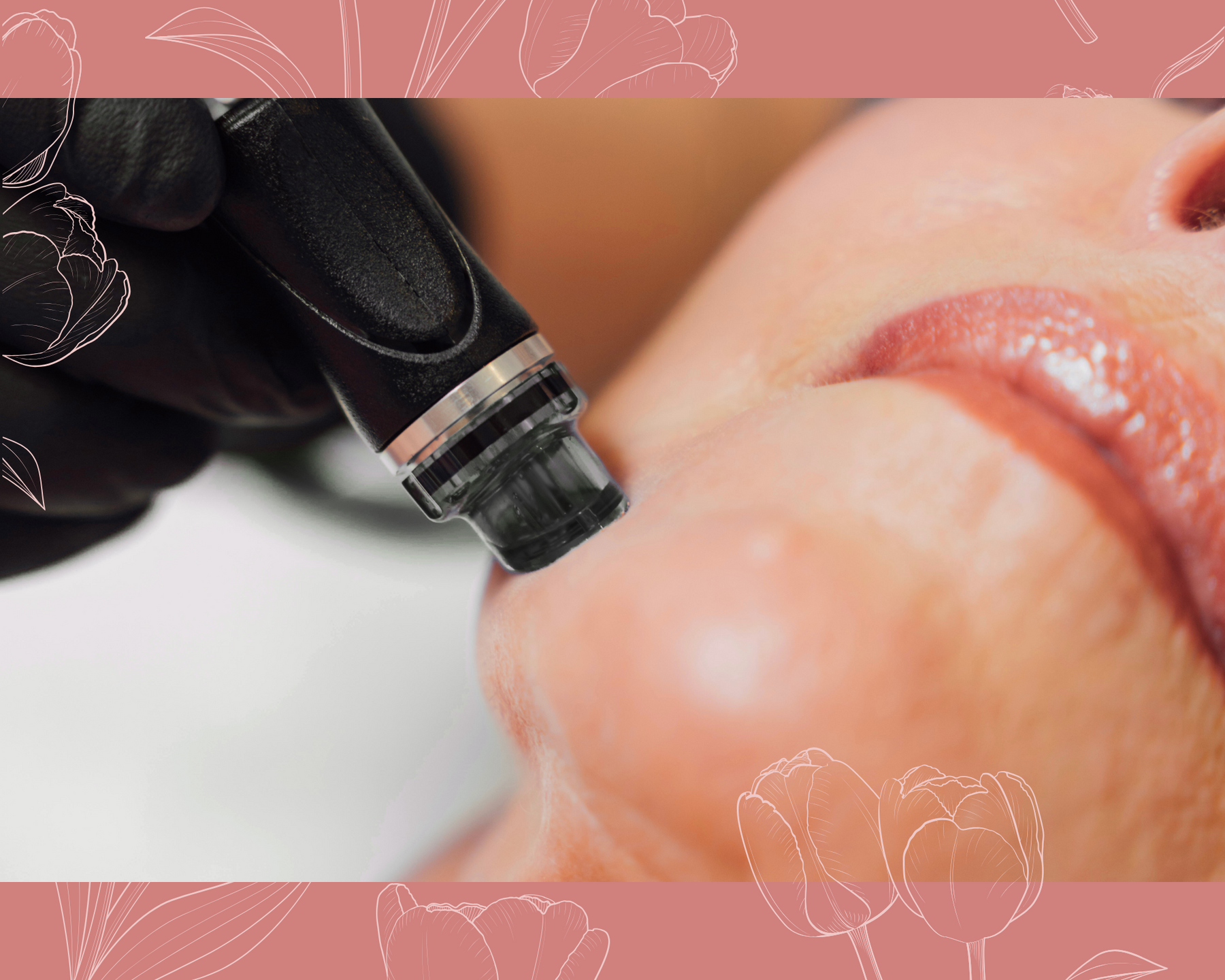 $50 Off Your Favorite Skin Treatments